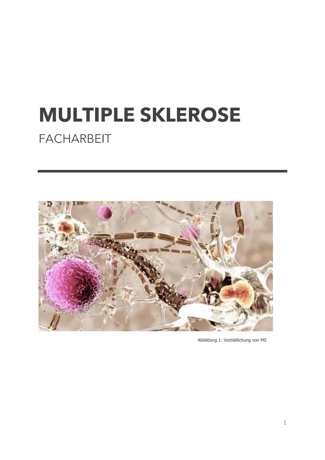 # Multiple Sklerose
Handout
## Definition
- Neurologische Autoimmunerkrankung
- Entzündliche Erkrankung des zentralen Nervensystems
## Was