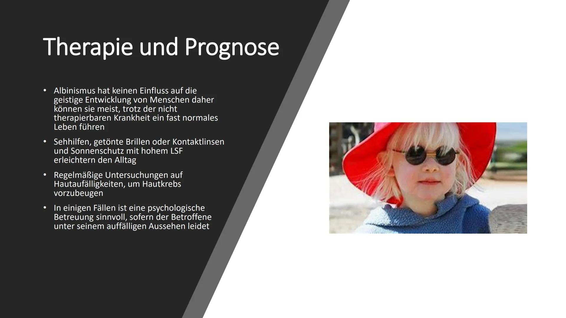 ALBINISMUS # Inhaltsverzeichnis
* Was ist Albinismus ?
* Symptome und Beschwerden
* Genetische Ursachen und Erbgang
* Unterschiedli