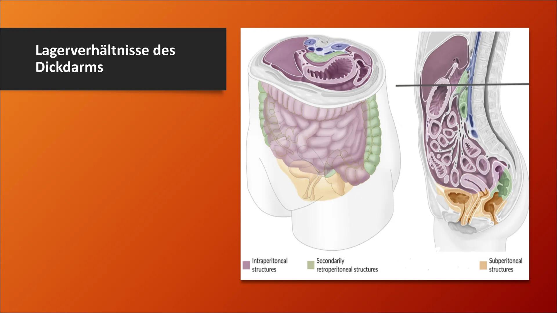 # Der Dickdarm
Lateinisch: Intestinum crassum Inhaltsverzeichnis
1. Die Bauhin'sche Klappe
2. Der Aufbau
3. Der Lagerverhältnisse des Dick