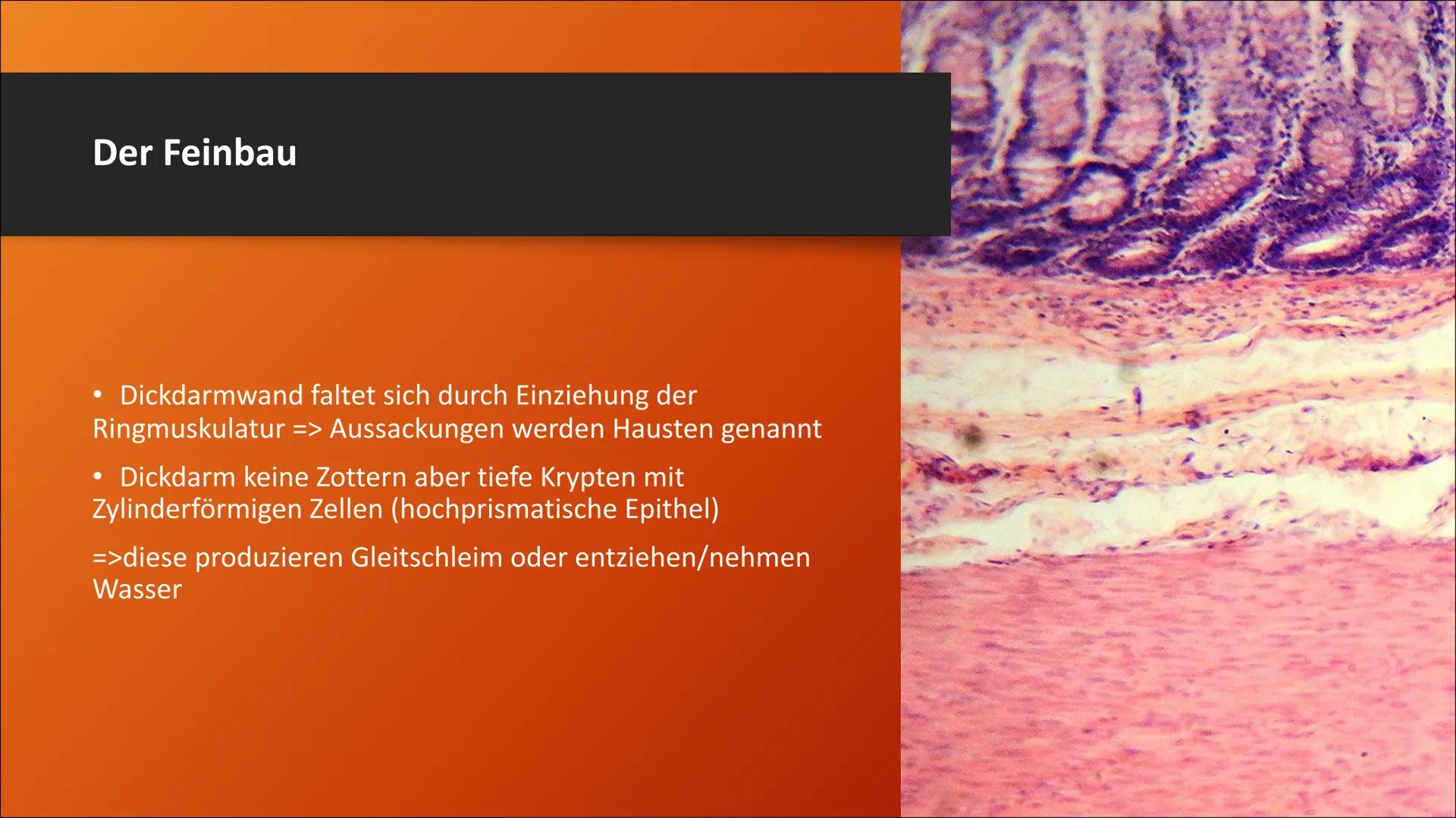 # Der Dickdarm
Lateinisch: Intestinum crassum Inhaltsverzeichnis
1. Die Bauhin'sche Klappe
2. Der Aufbau
3. Der Lagerverhältnisse des Dick