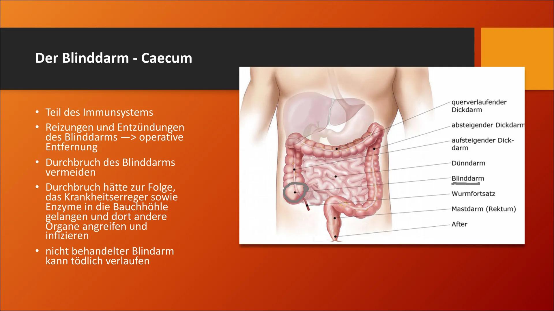 # Der Dickdarm
Lateinisch: Intestinum crassum Inhaltsverzeichnis
1. Die Bauhin'sche Klappe
2. Der Aufbau
3. Der Lagerverhältnisse des Dick