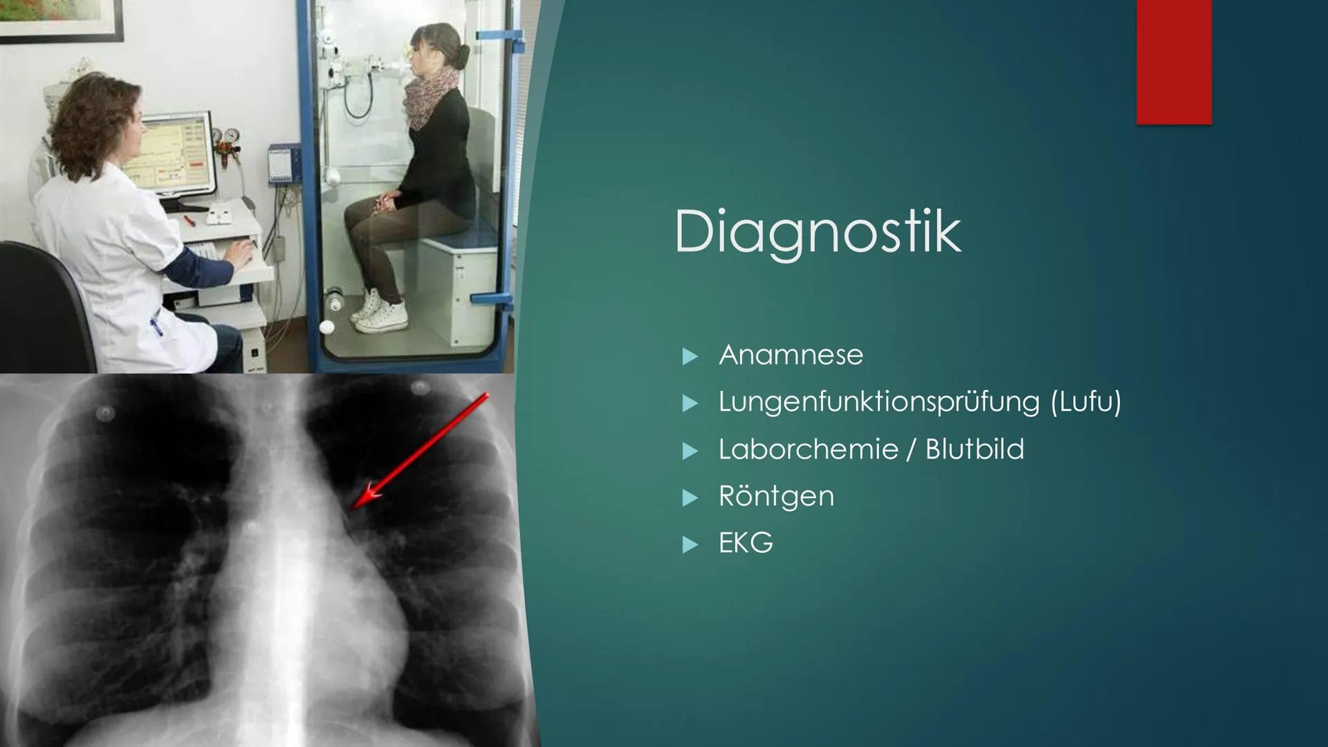 Asthma Bronchiale Definition
Asthma bronchiale bedeutet so viel
wie Kurzatmigkeit oder Atemnot
Das Asthma Bronchiale ist eine
chronisch-entz