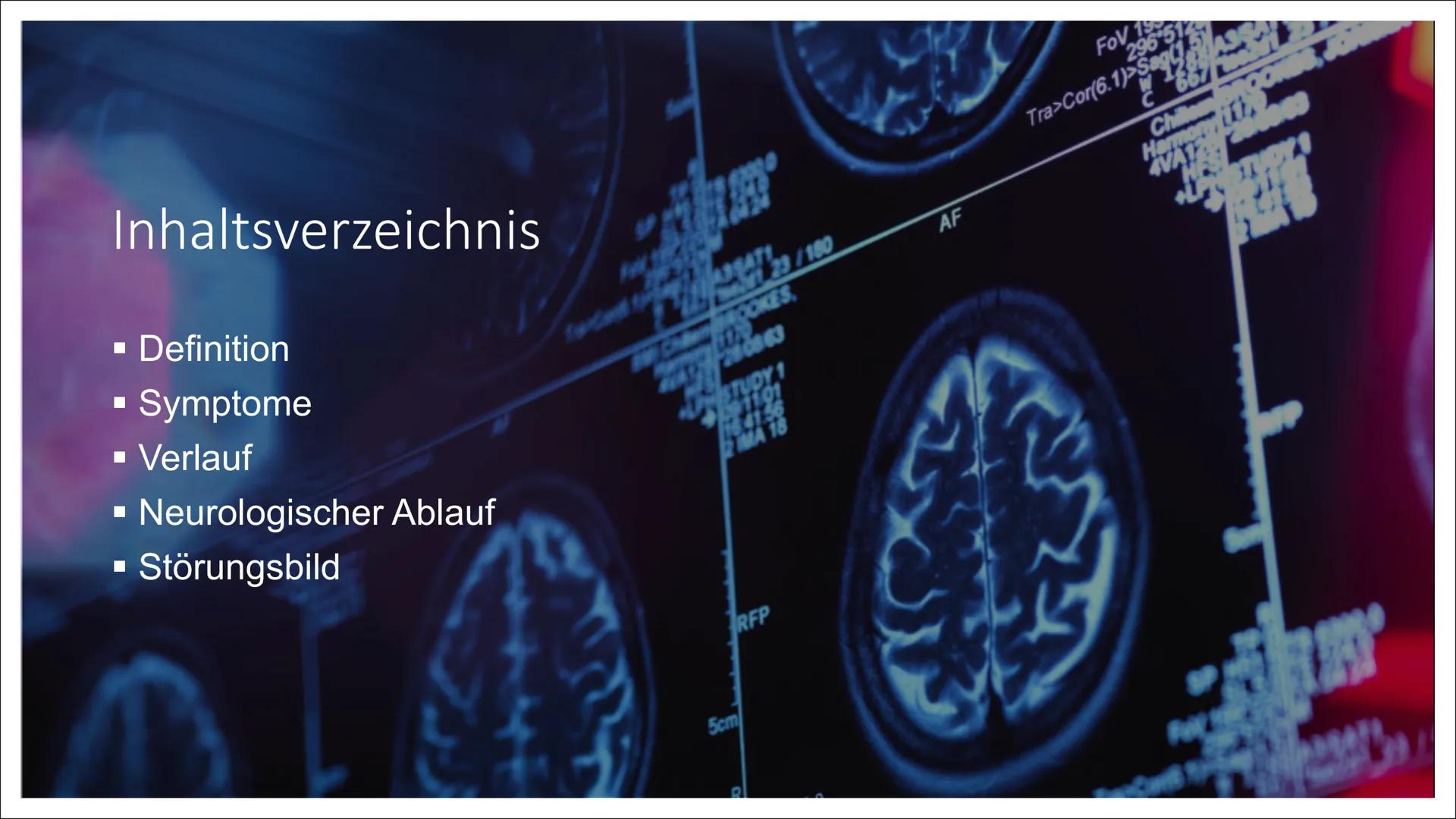 # Posttraumatische
# Belastungsstörung Inhaltsverzeichnis
■ Definition
■ Symptome
■ Verlauf
■ Neurologischer Ablauf
■ Störungsbild
A3S