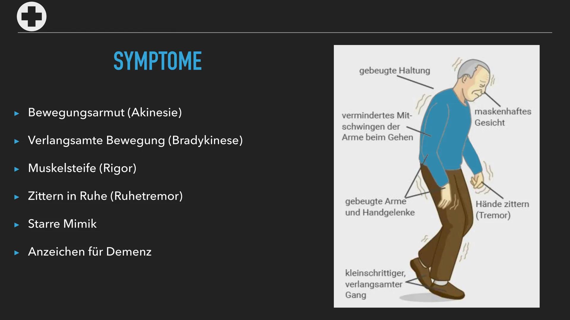 PARKINSON Q
Was ist
Parkinson?
Gliederung
+
Symptome
Ursachen
und
Diagnose
Verlauf
D
Medikamente
und
Behandlung Q
WAS IST PARKINSON?
▸ Nach