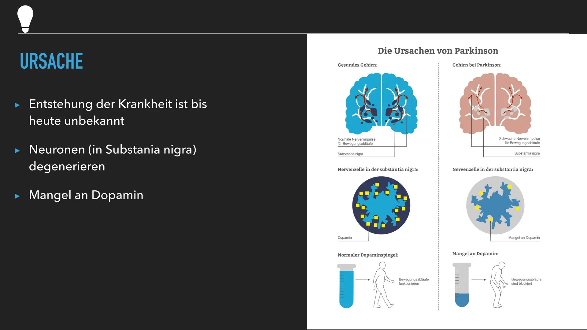 PARKINSON Q
Was ist
Parkinson?
Gliederung
+
Symptome
Ursachen
und
Diagnose
Verlauf
D
Medikamente
und
Behandlung Q
WAS IST PARKINSON?
▸ Nach