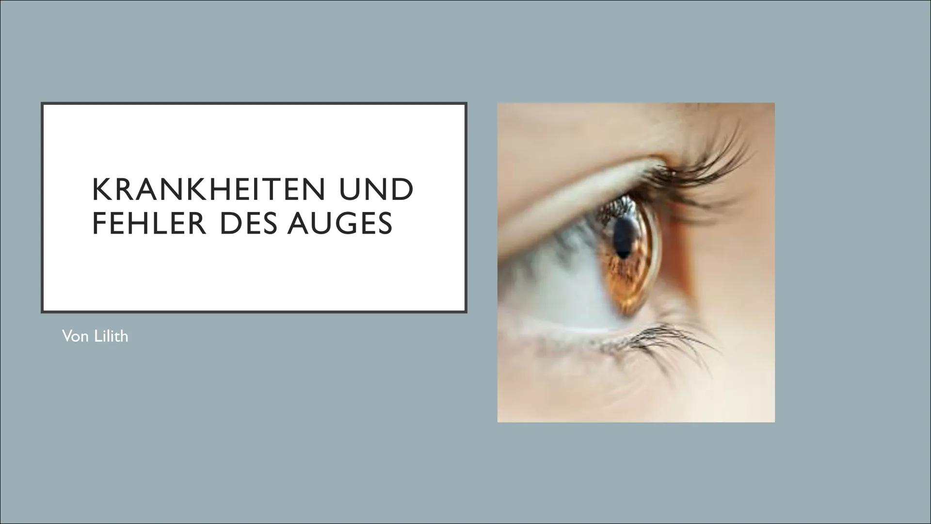 KRANKHEITEN UND
FEHLER DES AUGES
Von Lilith INHALTSVERZEICHNIS
1. Exkurs: Aufbau der Linse
2. Grau Star
3. Schielen
4. Grün Star
5. Weitsi