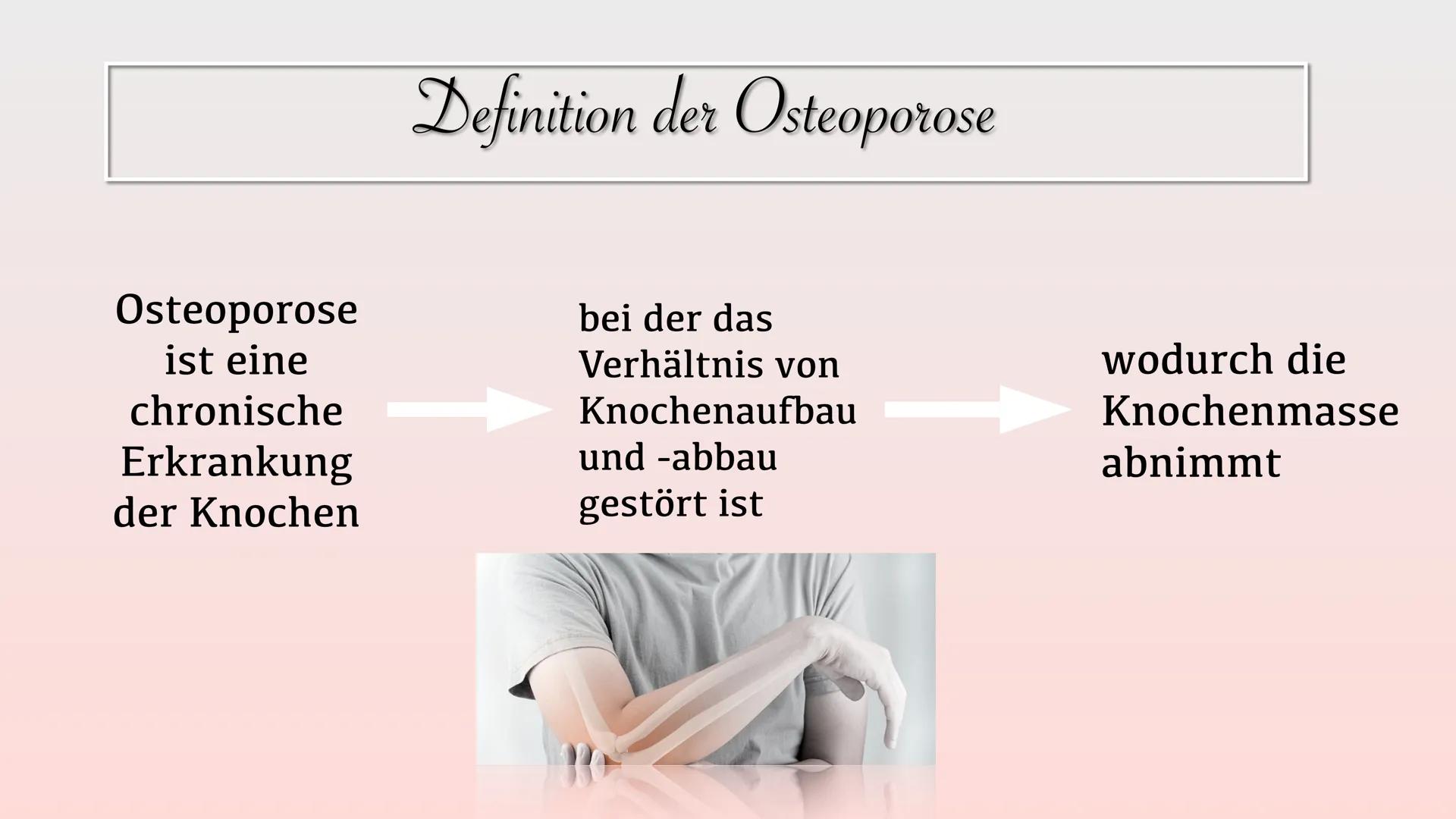 # Osteoporose
40 jahre
Normal
60 jahre
reduzierte
Knochenmasse
70 jahre
Osteoporose Gliederung
• Definition
• Welche Knochen sind
be