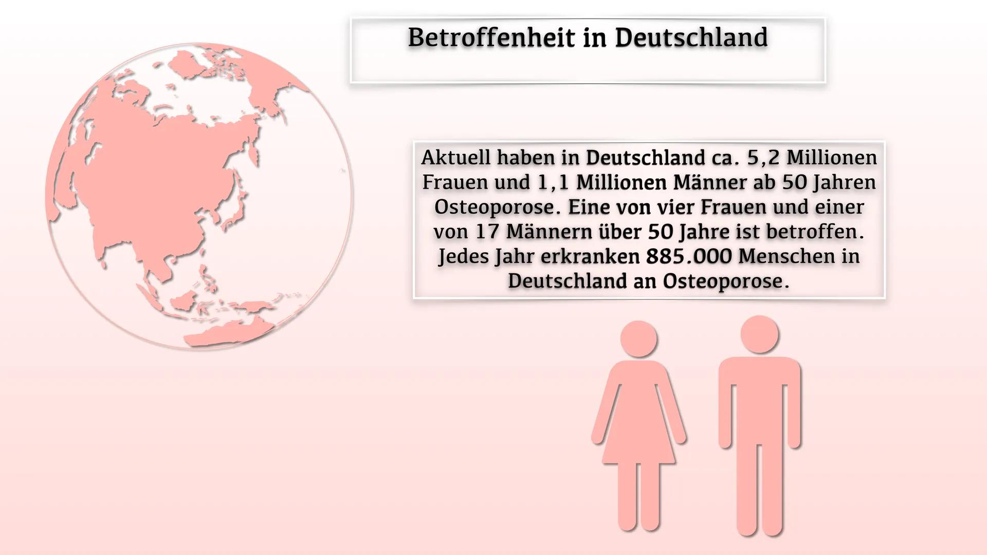 # Osteoporose
40 jahre
Normal
60 jahre
reduzierte
Knochenmasse
70 jahre
Osteoporose Gliederung
• Definition
• Welche Knochen sind
be