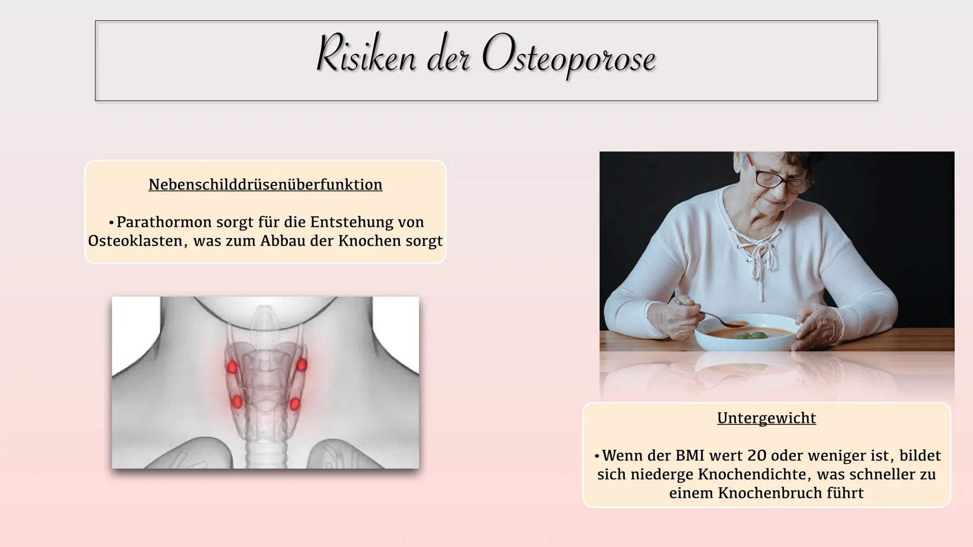 # Osteoporose
40 jahre
Normal
60 jahre
reduzierte
Knochenmasse
70 jahre
Osteoporose Gliederung
• Definition
• Welche Knochen sind
be