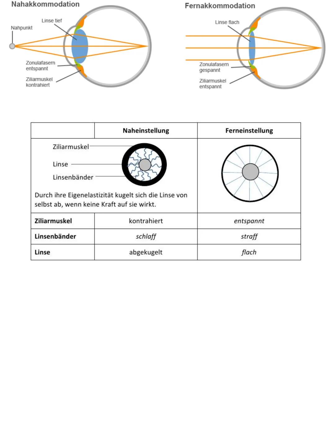 Retina
Ziliarmuskel
Augenlid
Wimpern
Iris
Pupille
Augenkammer
Hornhaut
Linse
Linsenbänder
Lederhaut
Muskel
Bestandteile
Linse
Linsenbänder u