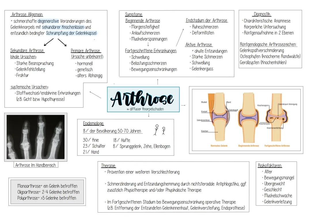 Arthrose
